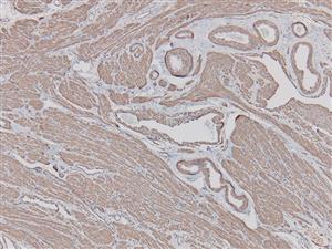 3003B | Control Slides:Immunopathology; Actin, Smooth Muscle